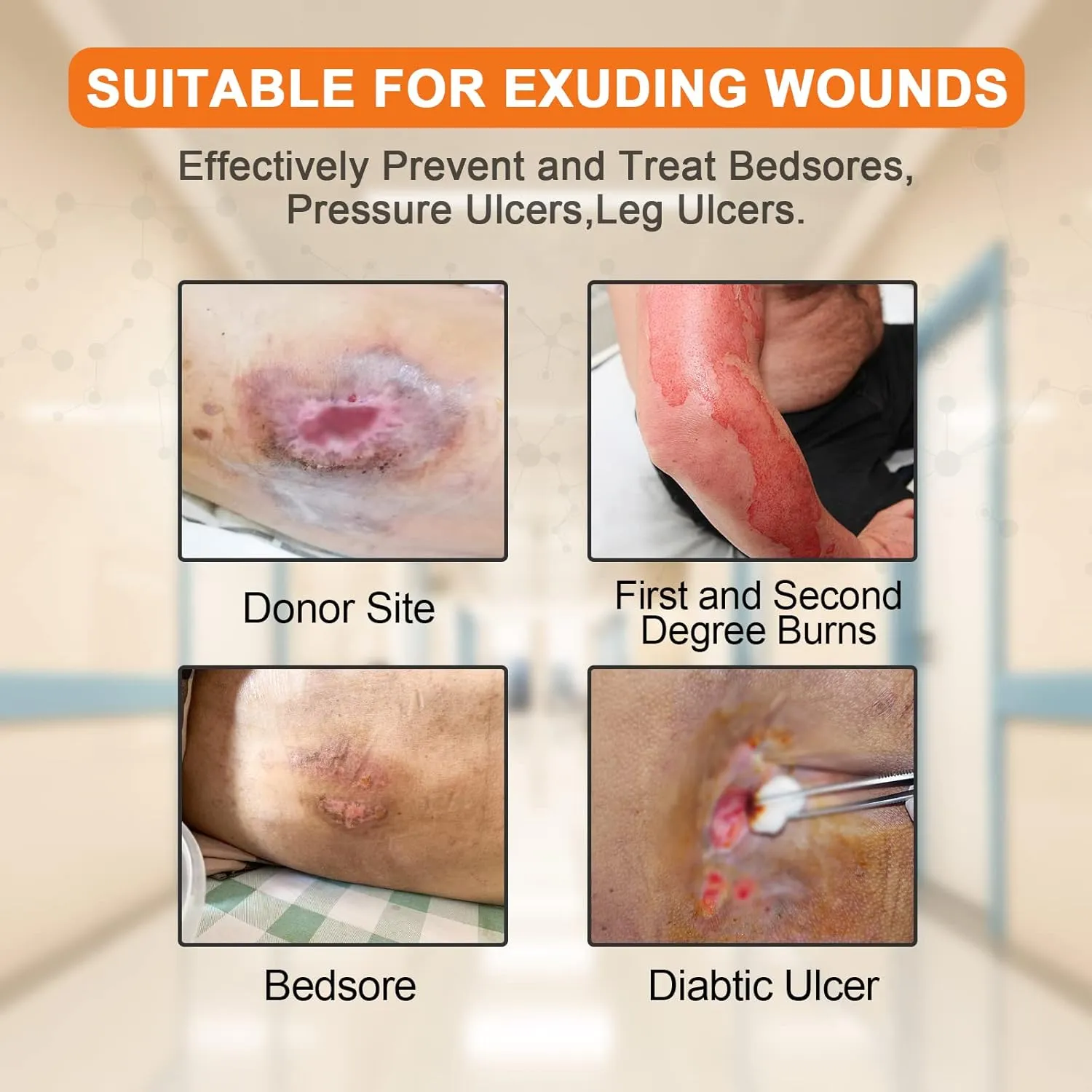 Carbou 5Pcs Silicone Foam Dressing 6" x 6" (15cmx15cm) - Square Wound Care Dressing with Border Adhesive Waterproof Central Ultra Absorbent-Foam(4.3" X 4.3") Waterproof Silicone Wound Bandage